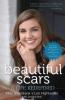 Cover image of Beautiful scars