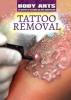 Cover image of Tattoo removal