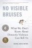 Cover image of No visible bruises